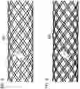 Fig. 07 - WOVEN STENT