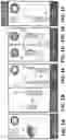 Fig. 02 - Tools for transurethral deployment and fixation of graft for the management and treatment of urethral strictures