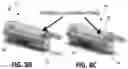 Fig. 26 - Tools for transurethral deployment and fixation of graft for the management and treatment of urethral strictures