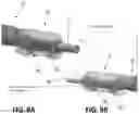 Fig. 27 - Tools for transurethral deployment and fixation of graft for the management and treatment of urethral strictures