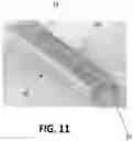 Fig. 29 - Tools for transurethral deployment and fixation of graft for the management and treatment of urethral strictures
