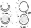 Fig. 31 - Tools for transurethral deployment and fixation of graft for the management and treatment of urethral strictures