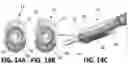 Fig. 32 - Tools for transurethral deployment and fixation of graft for the management and treatment of urethral strictures