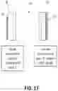 Fig. 35 - Tools for transurethral deployment and fixation of graft for the management and treatment of urethral strictures