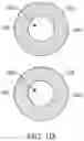 Fig. 04 - Bifurcated implant delivery system
