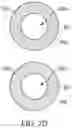 Fig. 07 - Bifurcated implant delivery system
