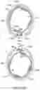 Fig. 27 - Bifurcated implant delivery system