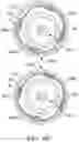 Fig. 44 - Bifurcated implant delivery system