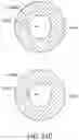 Fig. 60 - Bifurcated implant delivery system