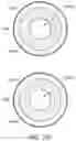 Fig. 63 - Bifurcated implant delivery system
