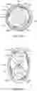 Fig. 70 - Bifurcated implant delivery system