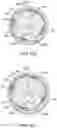 Fig. 76 - Bifurcated implant delivery system
