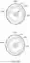 Fig. 79 - Bifurcated implant delivery system