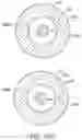 Fig. 80 - Bifurcated implant delivery system