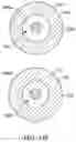 Fig. 84 - Bifurcated implant delivery system