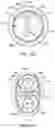 Fig. 86 - Bifurcated implant delivery system