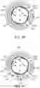 Fig. 09 - Method and apparatuses for deploying an implant