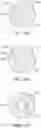 Fig. 16 - Method and apparatuses for deploying an implant