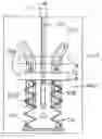 Fig. 01 - Intraluminal implant delivery system and method