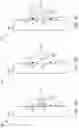 Fig. 12 - Medical device delivery systems and methods