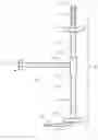 Fig. 01 - Biliary Diversion Catheter