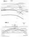 Fig. 05 - Biliary Diversion Catheter
