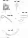 Fig. 16 - Biliary Diversion Catheter