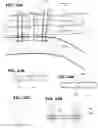 Fig. 19 - Biliary Diversion Catheter