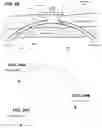 Fig. 20 - Biliary Diversion Catheter