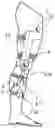 Fig. 01 - KNEE ERGONOMIC DEVICE FOR RESOLVING THE VERTICAL LOADS