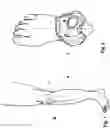 Fig. 02 - KNEE ERGONOMIC DEVICE FOR RESOLVING THE VERTICAL LOADS