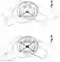 Fig. 16 - KNEE ERGONOMIC DEVICE FOR RESOLVING THE VERTICAL LOADS
