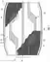 Fig. 03 - Hernia belt