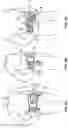 Fig. 04 - Hernia belt