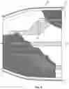 Fig. 05 - Hernia belt