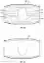 Fig. 08 - Hernia belt