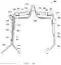 Fig. 06 - Projection frame eyelid heater