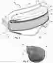 Fig. 03 - System for treatment of eye conditions