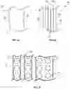 Fig. 08 - Corneal implant systems and methods