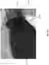 Fig. 28 - Wound closure devices