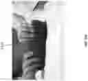 Fig. 37 - Wound closure devices