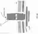 Fig. 41 - Wound closure devices