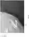 Fig. 46 - Wound closure devices