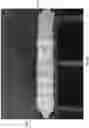 Fig. 48 - Wound closure devices