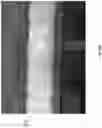 Fig. 49 - Wound closure devices
