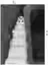 Fig. 50 - Wound closure devices