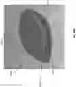 Fig. 55 - Wound closure devices