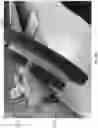Fig. 58 - Wound closure devices