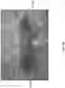 Fig. 75 - Wound closure devices