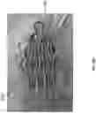 Fig. 77 - Wound closure devices